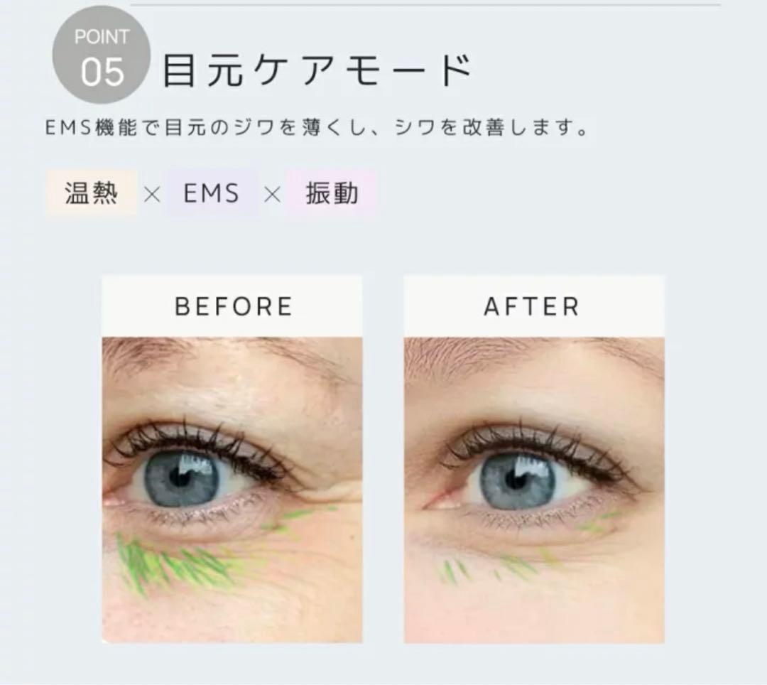 美顔器 EMS 顔 美顔器 多機能美顔器 リフトケア 冷却機能 4色LED