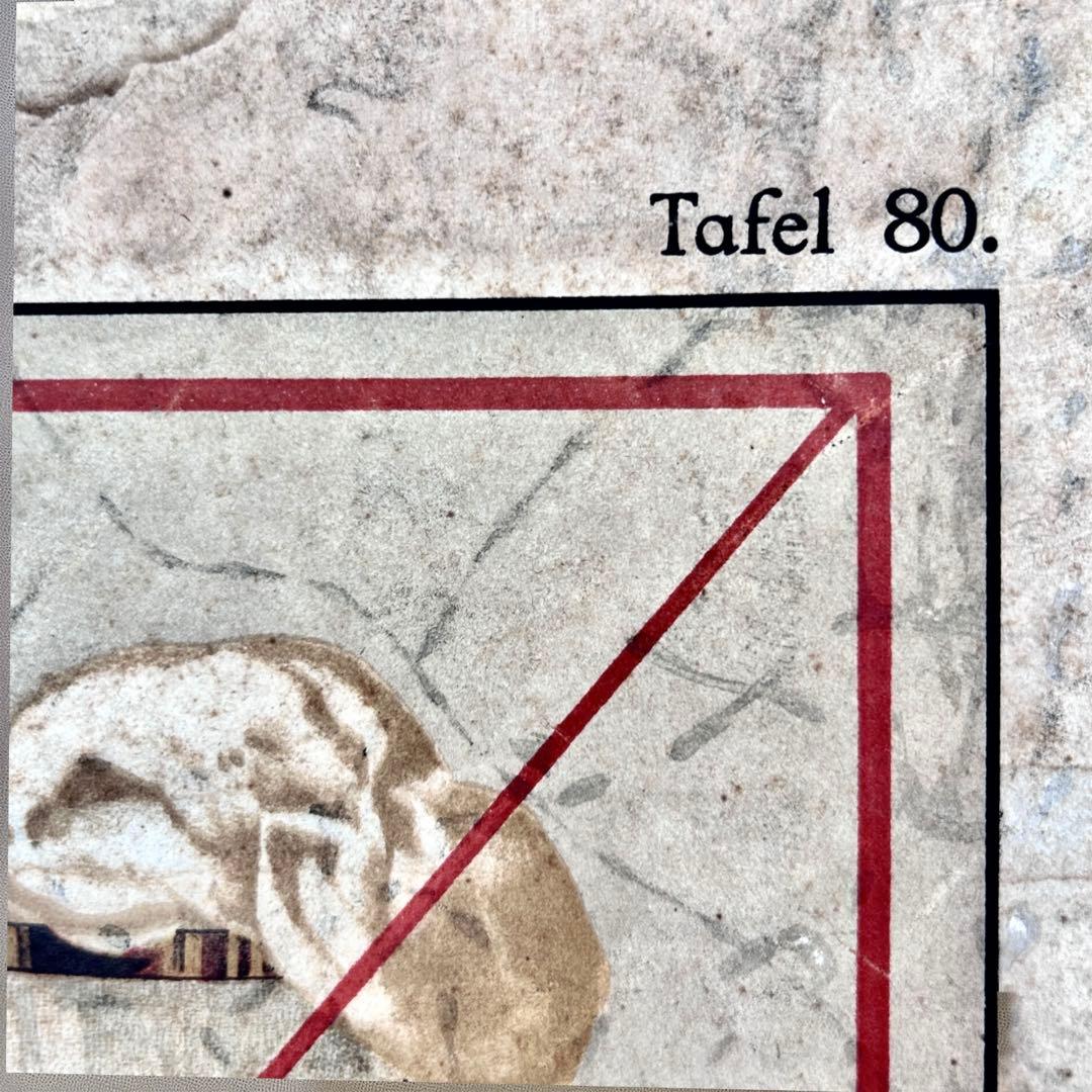 1927年 ドイツ製ベルリン ユリウス・シュプリンガー児童医療ポスター② A2判