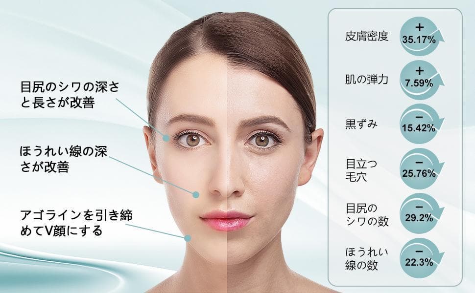 RF温冷美顔器 EMS 1台10役 光エステ Type-C充電式