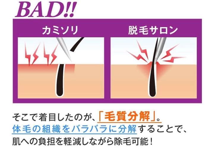 Zリムーバー　リムーバークリーム SP（200ml）脱毛