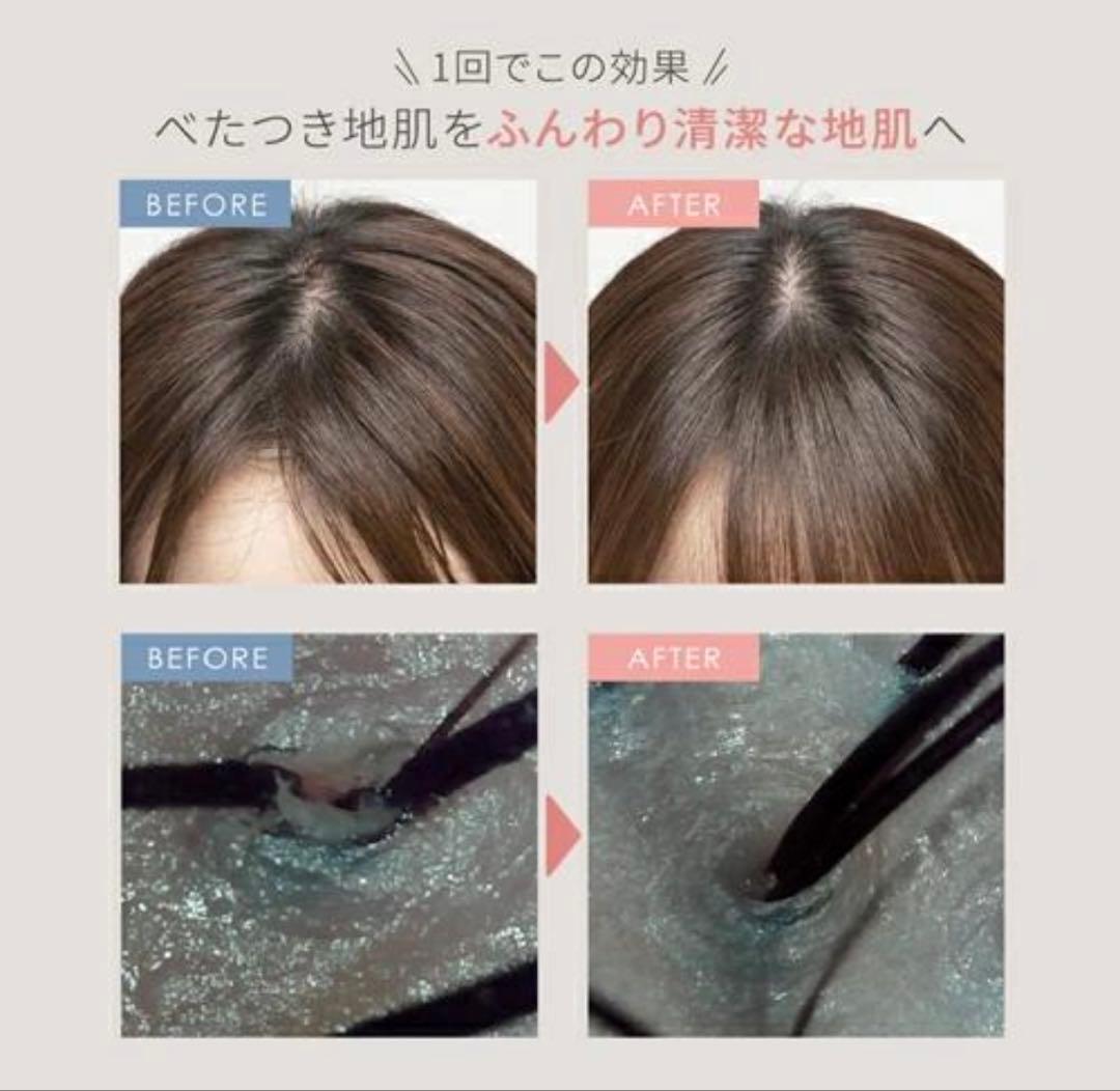 mysé EMS頭皮マッサージャー MS-33W ニードルヘッドスパ 【新品】