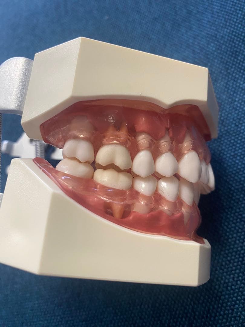 顎模型　人工歯石　セット売り　歯科