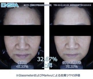 IONSPA ( イオンスパ ) プレミアム シャワーヘッド BATH1000α