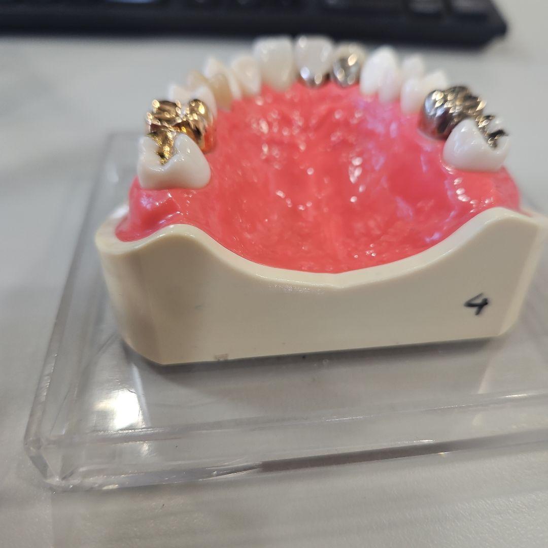 歯の模型