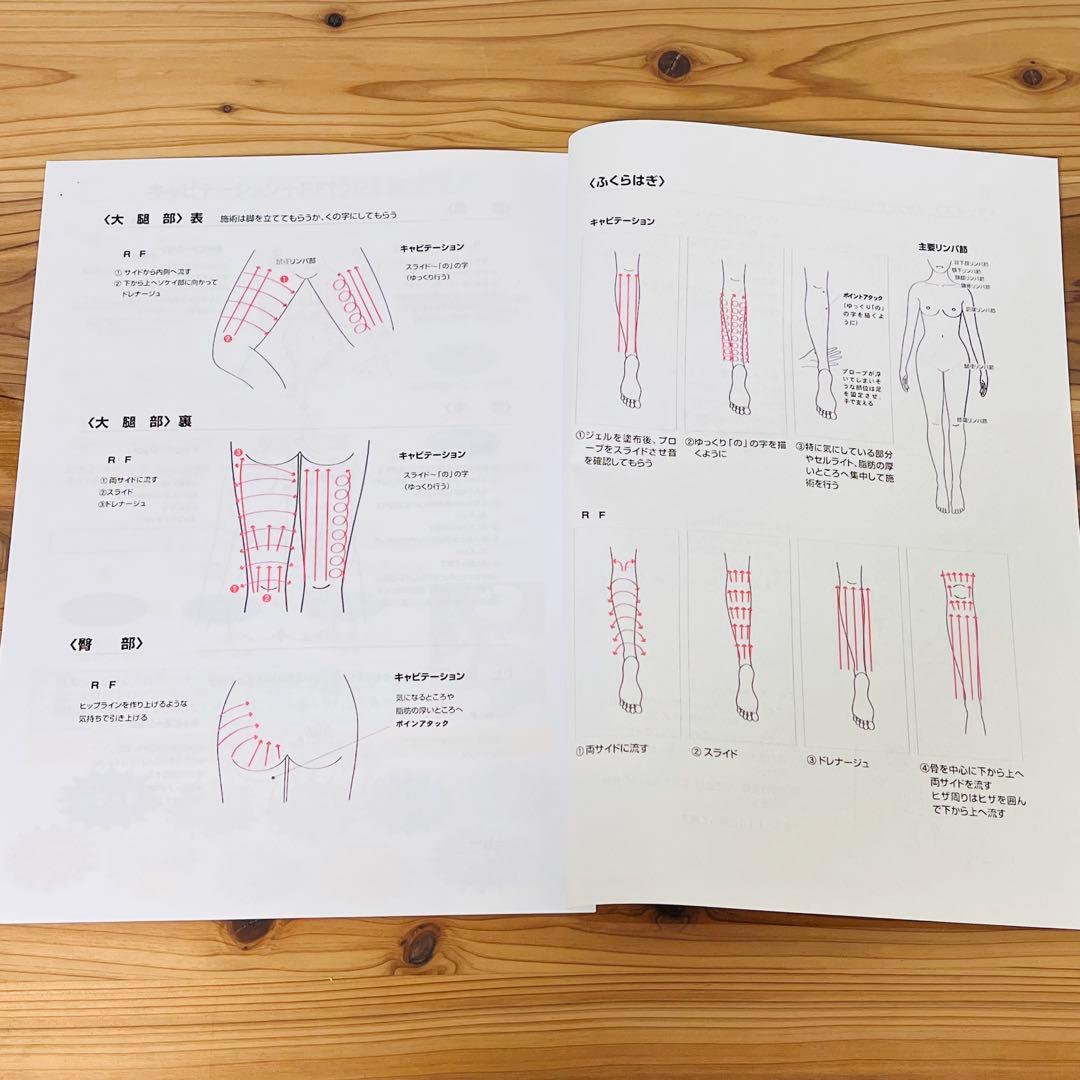 キャビエスト レディーバード スタンド付 40KHzキャビテーション