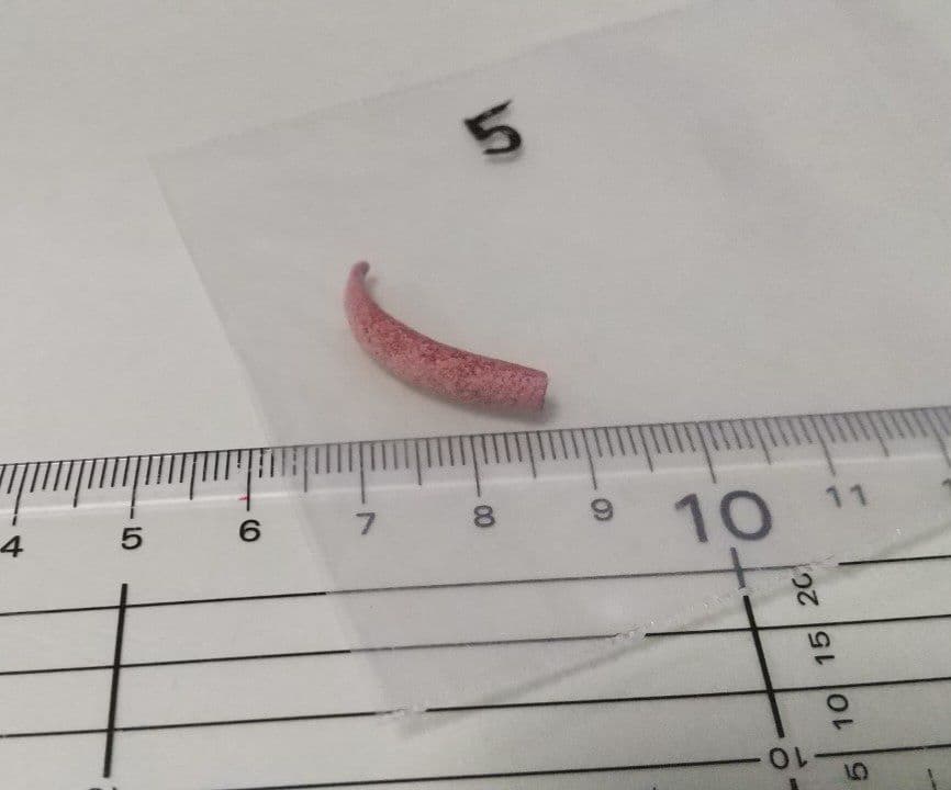 専用　yuun様ご確認用ウィリンキー ジェニー　ビカクシダ 胞子培養