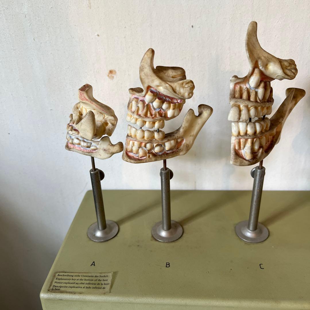 歯のモデル　発育模型